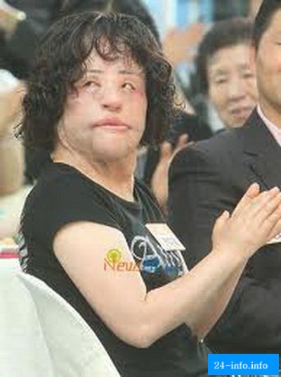 Женщина изуродовала себя