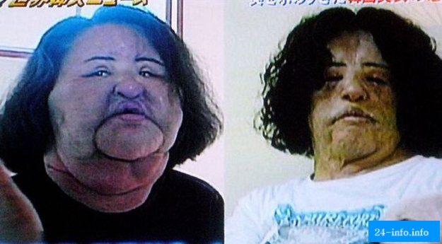 Женщина изуродовала себя