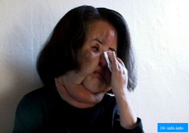 Женщина изуродовала себя