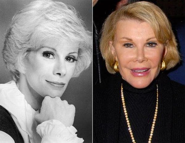 Джоан Риверс - рекордсменка по пластическим операциям