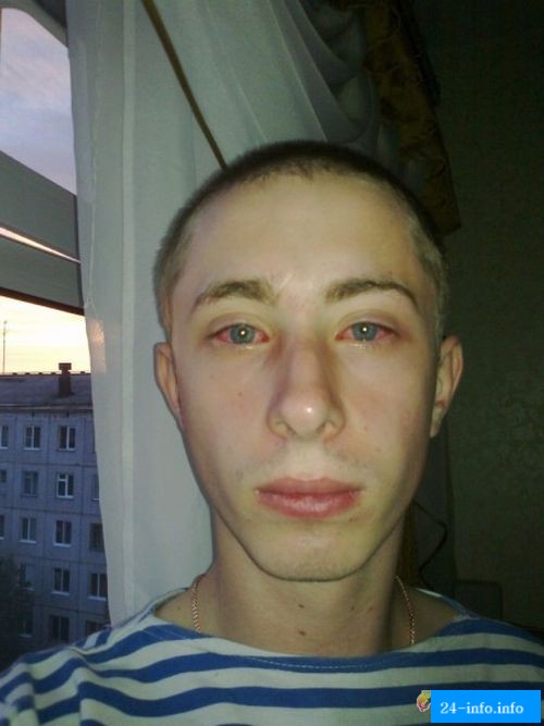 Посетители ночного клуба получили ожоги глаз (13 фото) Посетители ночного клуба получили ожоги глаз (13 фото)