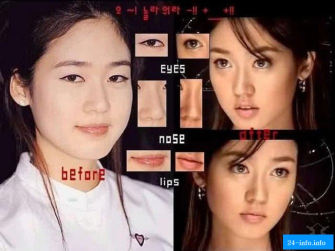 Бум пластической хирургии в Корее