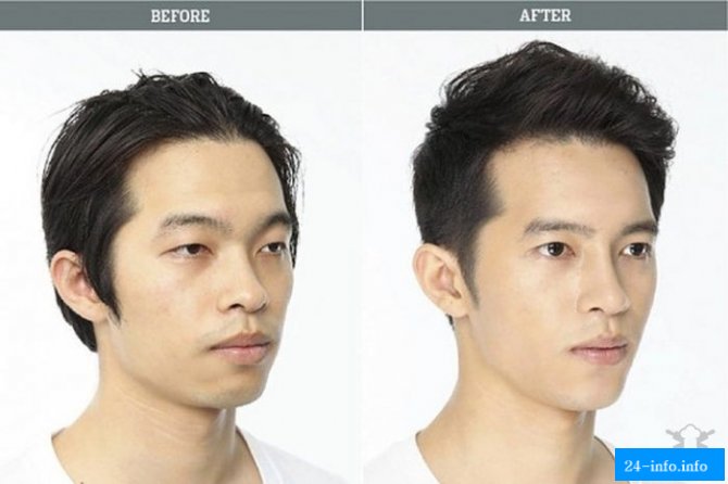 Бум пластической хирургии в Корее