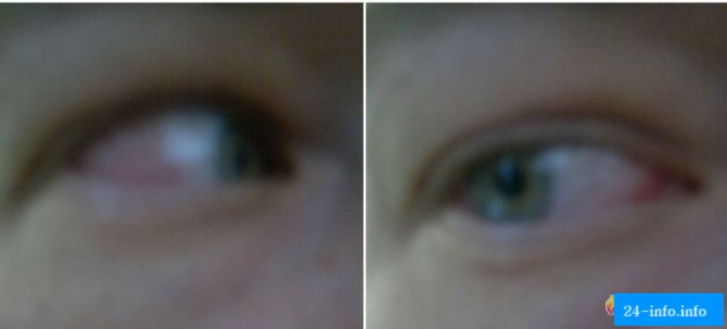 Посетители ночного клуба получили ожоги глаз (13 фото)