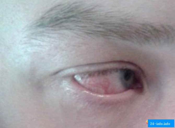 Посетители ночного клуба получили ожоги глаз (13 фото)