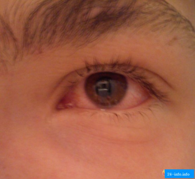 Посетители ночного клуба получили ожоги глаз (13 фото)