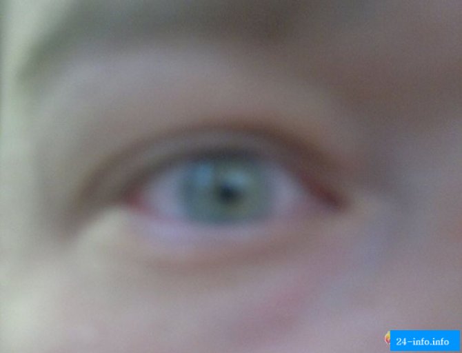 Посетители ночного клуба получили ожоги глаз (13 фото)