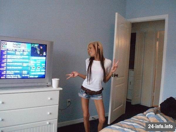 Болезнь худобы - анорексия Болезнь худобы - анорексия