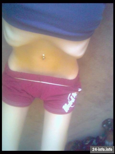 Болезнь худобы - анорексия Болезнь худобы - анорексия