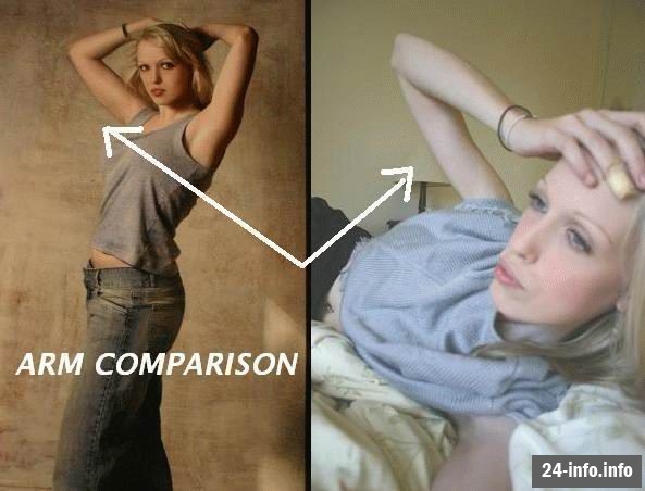 Болезнь худобы - анорексия Болезнь худобы - анорексия