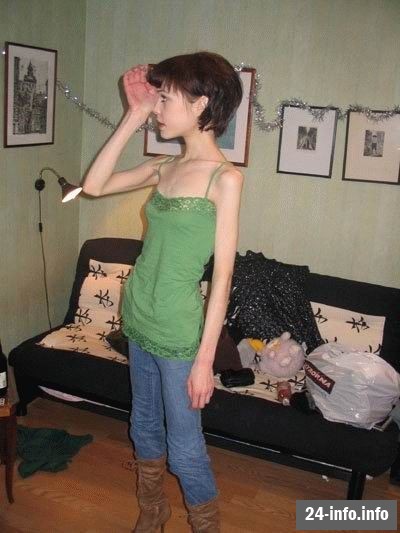 Болезнь худобы - анорексия Болезнь худобы - анорексия