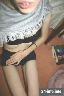 Болезнь худобы - анорексия Болезнь худобы - анорексия