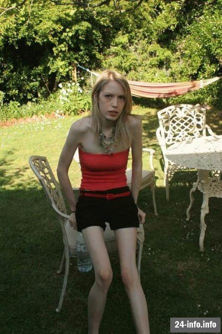 Болезнь худобы - анорексия