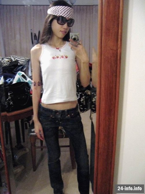 Болезнь худобы - анорексия