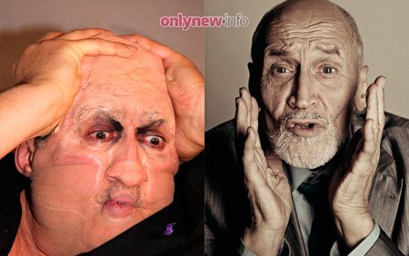 Садальский и Дроздов попали в больницу