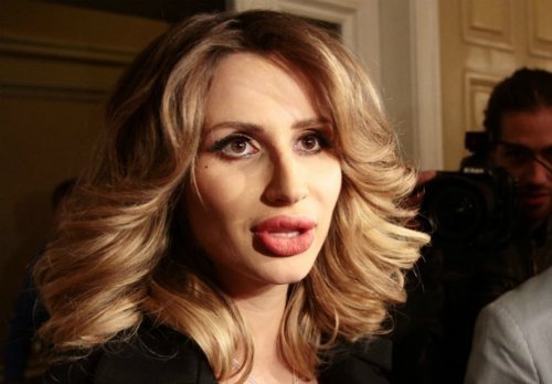 Светлана Лобода снова увеличила губы