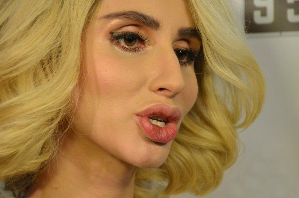 Светлана Лобода снова увеличила губы