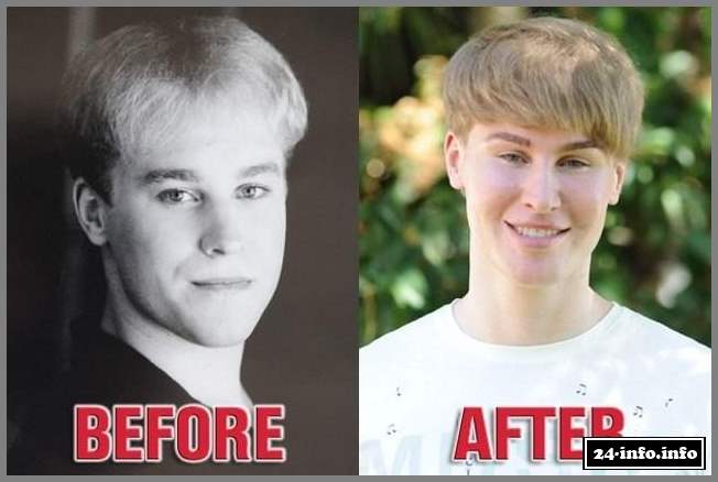 Фанат потратил $100,000 на пластическую операцию, чтобы походить на... Фанат потратил $100,000 на пластическую операцию, чтобы походить на...