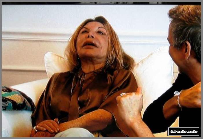 Эльза Паттон - жертва пластической хирургии (28 фото)