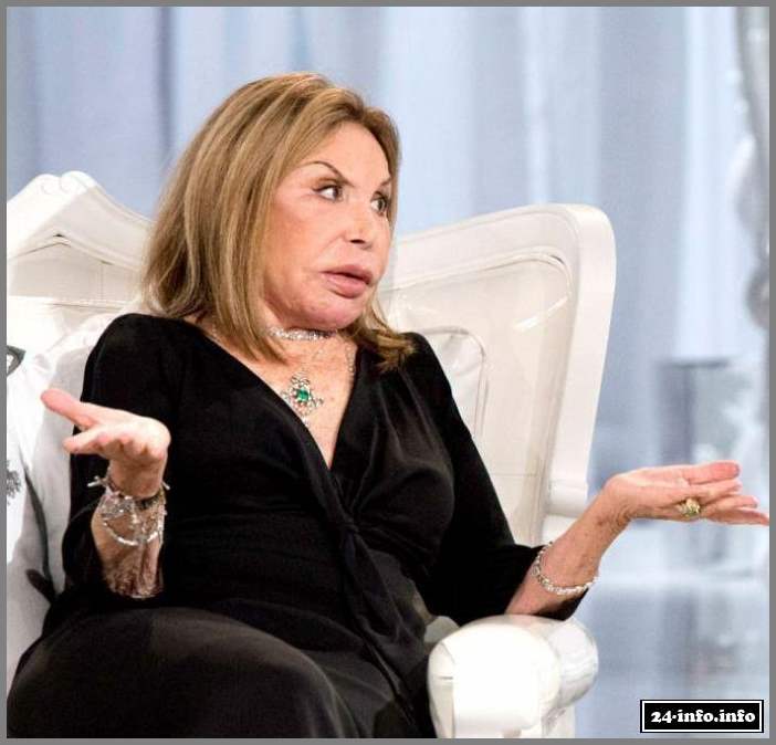 Эльза Паттон - жертва пластической хирургии (28 фото)
