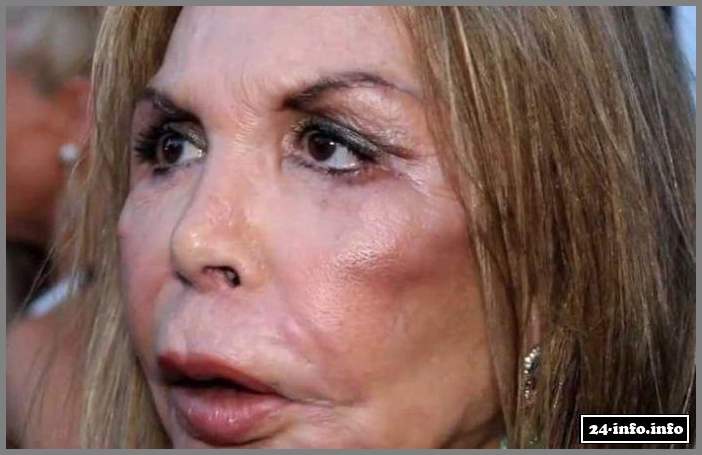 Эльза Паттон - жертва пластической хирургии (28 фото)