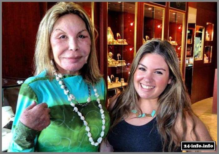 Эльза Паттон - жертва пластической хирургии (28 фото)