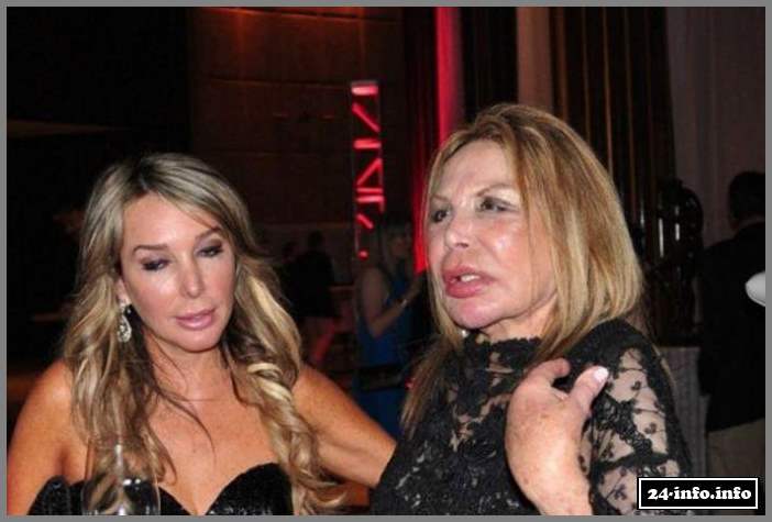 Эльза Паттон - жертва пластической хирургии (28 фото)