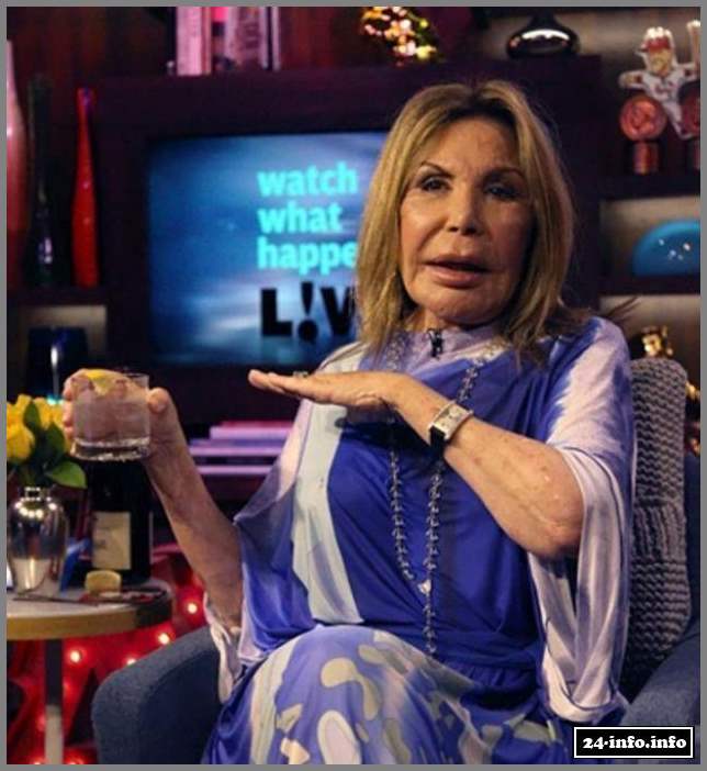 Эльза Паттон - жертва пластической хирургии (28 фото)