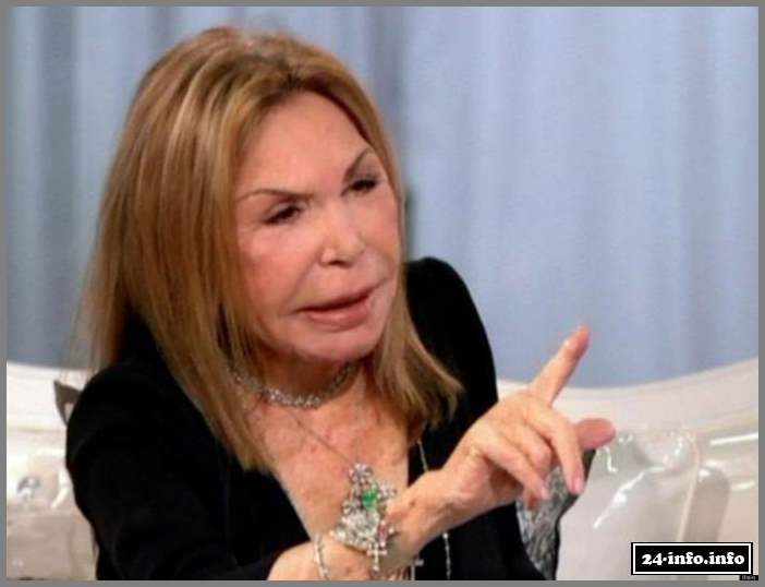 Эльза Паттон - жертва пластической хирургии (28 фото)