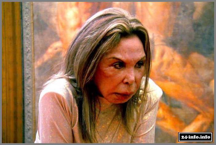 Эльза Паттон - жертва пластической хирургии (28 фото)