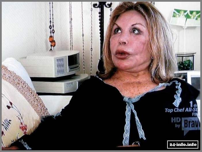 Эльза Паттон - жертва пластической хирургии (28 фото)