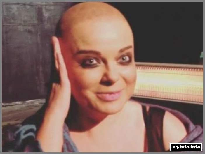 Наташа Королева побрилась налысо