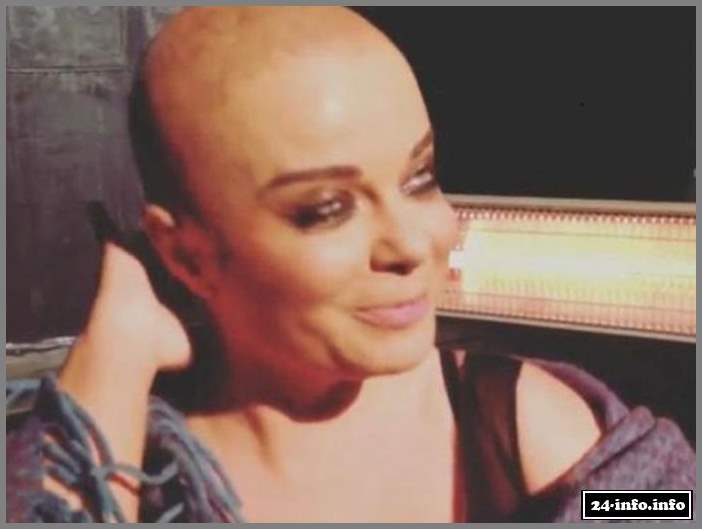 Наташа Королева побрилась налысо