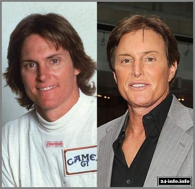 Из красавцев в аутсайдеры (13 фотографий)