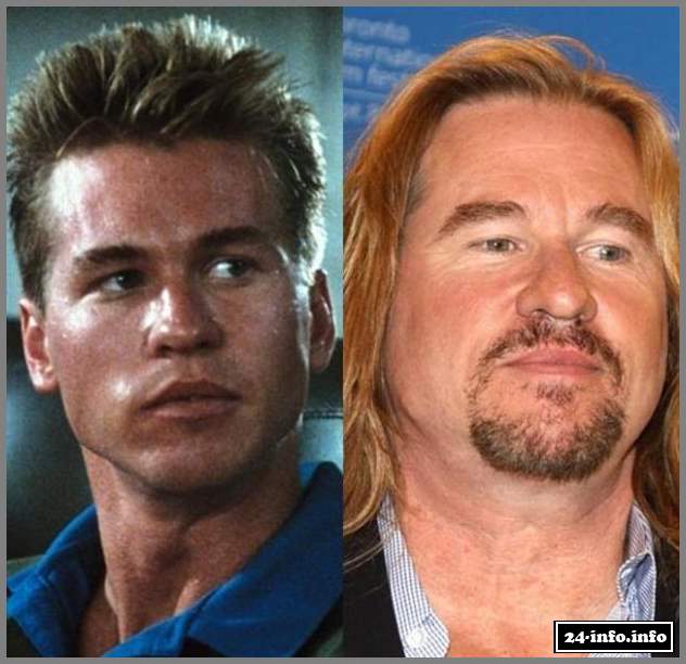 Из красавцев в аутсайдеры (13 фотографий)