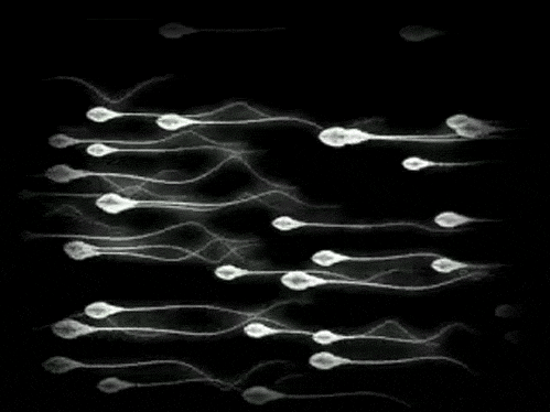 Волосня по всей письке - Эроприколы