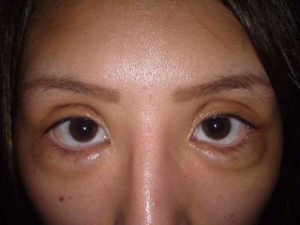 Японская порно-звезда до и после пластических операций