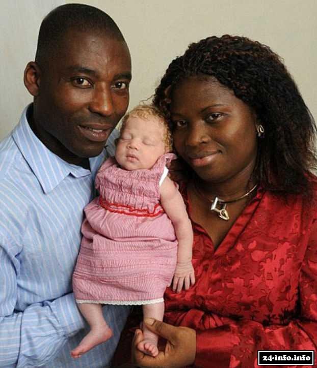 Чернокожая женщина поразила врачей, родив белого детка.