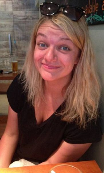 Девушке вытащили пиявку Девушке вытащили пиявку