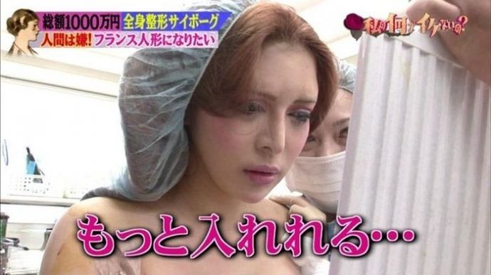 Японская модель "до и после" 30 пластических операций (15 фото)