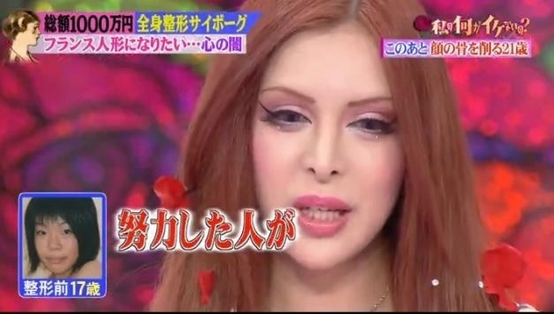 Японская модель "до и после" 30 пластических операций (15 фото)