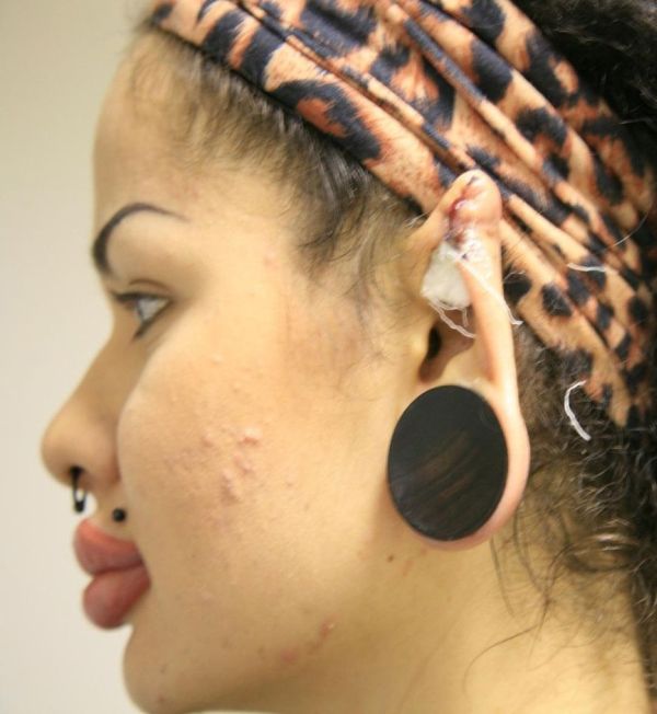 Новые уши Кристины Рэй Новые уши Кристины Рэй