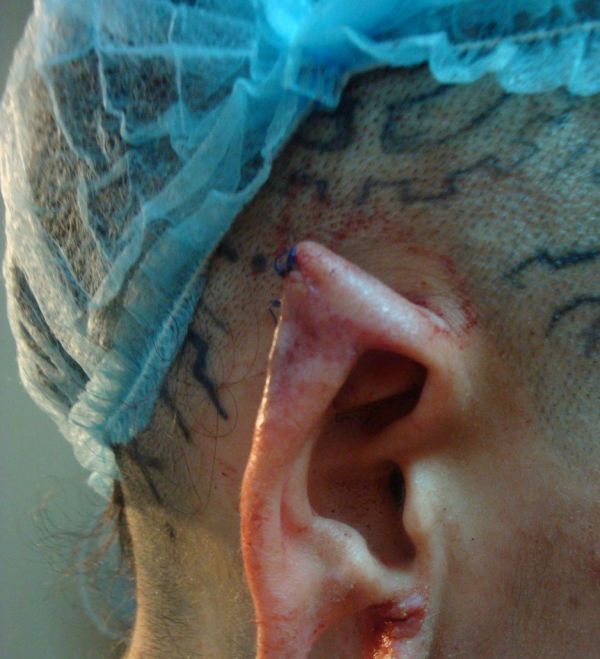 Новые уши Кристины Рэй Новые уши Кристины Рэй