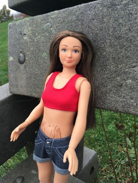 Барби наградили прыщами и целлюлитом Барби наградили прыщами и целлюлитом