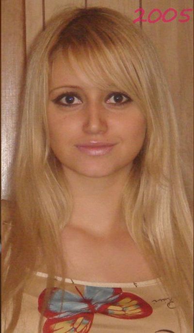 Девушка до и после операции