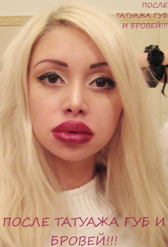 Девушка до и после операции