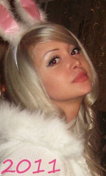 Девушка до и после операции