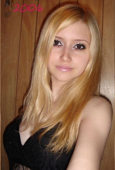 Девушка до и после операции