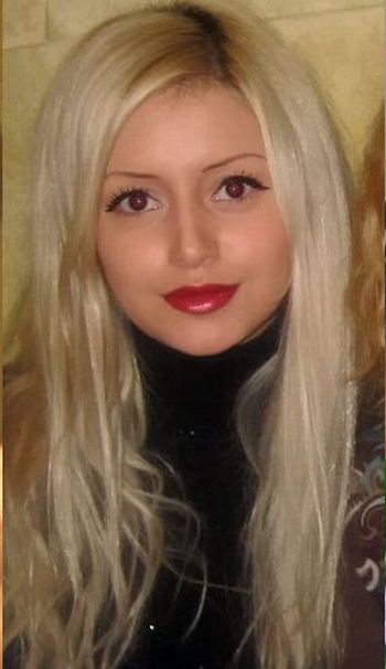 Девушка до и после операции