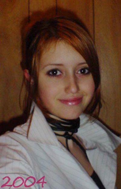 Девушка до и после операции